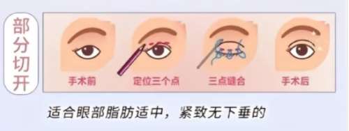 黄良飞医生个人简历信息精选来袭！医生背景|擅长项目介绍！插图3
