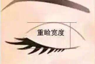 爱思特哪个医生做眼睛好?杨千里、郑颖平、彭远清口碑都不错!插图4 爱思特哪个医生做眼睛好?杨千里、郑颖平、彭远清口碑都不错!插图4