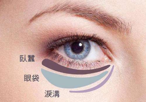 广州去眼袋文丽红口碑怎么样?审美前沿，改变自然插图1