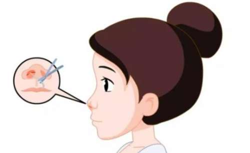 济南美莲整形韩旭医生擅长项目是什么？医生真实的顾客评价来袭！插图2
