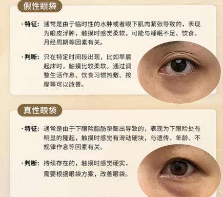 荆门去眼袋哪家强？top榜前五名单汇总！收藏再看插图4