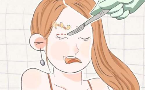 上海沈莺莺双眼皮修复好吗？技术怎么样？费用贵不贵？插图2