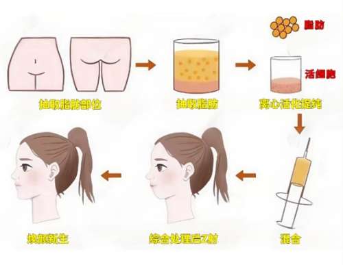 王荣锡医生现在在哪?医生作风优良且技术可靠!插图3 王荣锡医生现在在哪?医生作风优良且技术可靠!插图3
