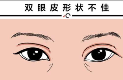 北京双眼皮修复专家张冰洁医生简介！医美免费咨询，了解公立医院实力！插图2