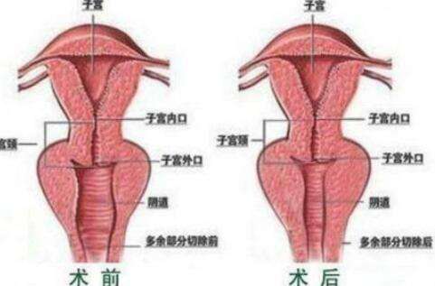 杨芒利医生擅长做什么?医生基本资料及热门项目介绍!插图3 杨芒利医生擅长做什么?医生基本资料及热门项目介绍!插图3