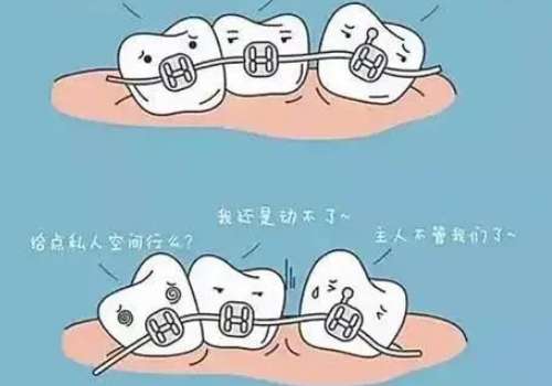 北京正畸医院张斐然简介!内附坐诊医院及科普知识!插图2 北京正畸医院张斐然简介!内附坐诊医院及科普知识!插图2