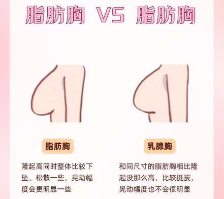 合肥隆胸医生排名哪个好?2026全新医生排行榜出炉!一键查看插图4 合肥隆胸医生排名哪个好?2026全新医生排行榜出炉!一键查看插图4