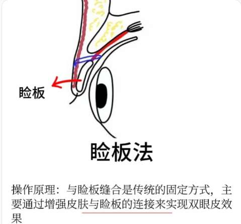 沈阳双眼皮推荐好的医生有哪些?医生擅长眼部综合整形!插图4 沈阳双眼皮推荐好的医生有哪些?医生擅长眼部综合整形!插图4