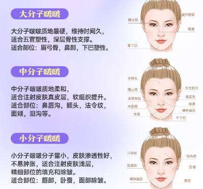 上海九院注射玻尿酸好的医生都有谁?网友力荐榜单揭晓插图4 上海九院注射玻尿酸好的医生都有谁?网友力荐榜单揭晓插图4