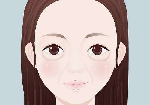 卢尚兵做眼袋手术怎么样?内附医生信息与技术详情!插图3 卢尚兵做眼袋手术怎么样?内附医生信息与技术详情!插图3