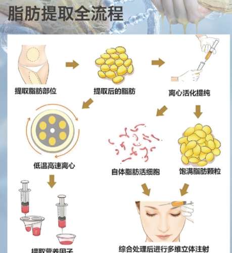 武汉中心医院整形外科医生名单|杨名、李天兴、刘娟等技术在线！插图3