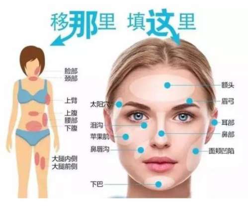 广州做脂肪填充很厉害的医生排名前5,冯传波、黎志明等,三甲公立坐诊插图2 广州做脂肪填充很厉害的医生排名前5,冯传波、黎志明等,三甲公立坐诊插图2