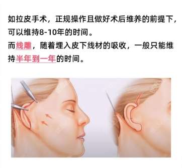 汤张洪医生做拉皮好吗?技术如何?顾客真实经历附上!插图4 汤张洪医生做拉皮好吗?技术如何?顾客真实经历附上!插图4