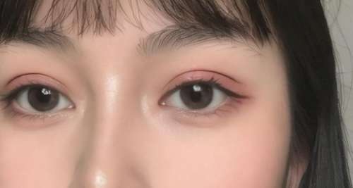 李哲权医生技术优势是什么?眼部整形特色分享!插图3 李哲权医生技术优势是什么?眼部整形特色分享!插图3