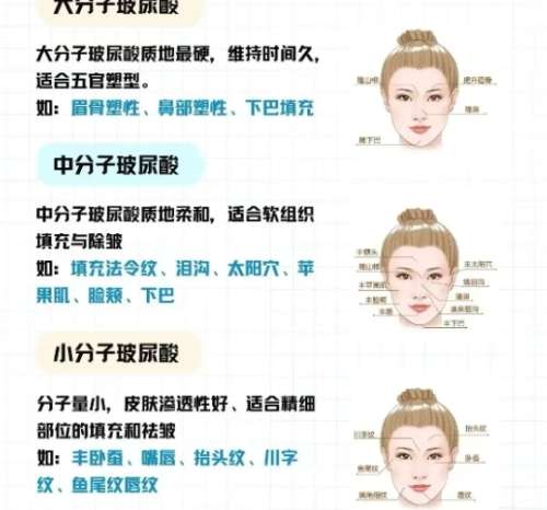 上海第二人民医院填充手术费用贵不贵?价目表更新!插图2 上海第二人民医院填充手术费用贵不贵?价目表更新!插图2