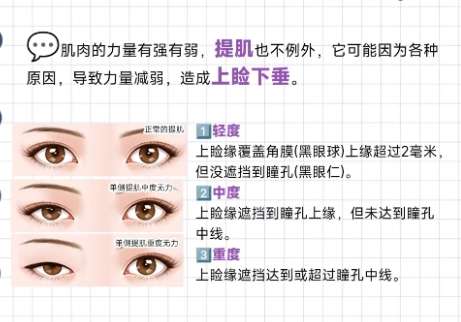 重庆双眼皮厉害三个医生!个人亮点详细介绍!插图4 重庆双眼皮厉害三个医生!个人亮点详细介绍!插图4