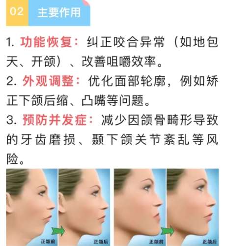 成都正颌手术医生排名!医生个人资料简介!插图4 成都正颌手术医生排名!医生个人资料简介!插图4