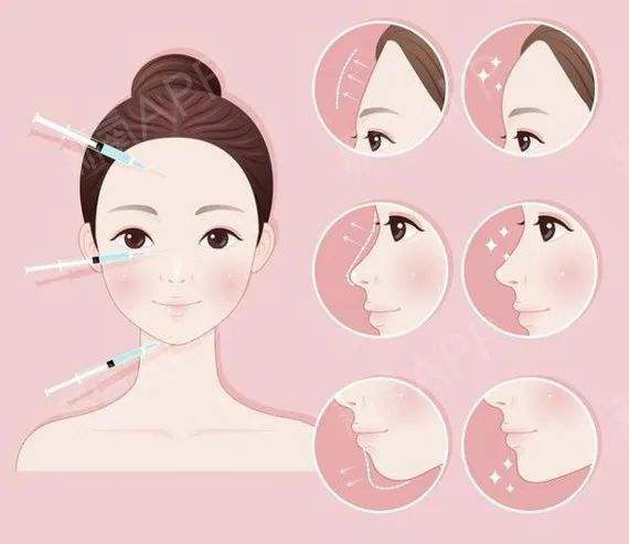 面部填充能维持多久？填充后注意事项有哪些？插图