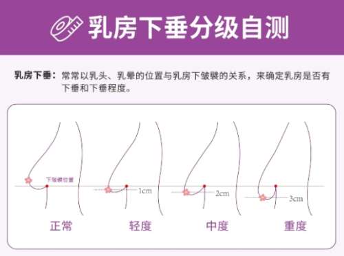 济南丰胸医生排名!医生经验丰富以及专业能力详细信息!插图4 济南丰胸医生排名!医生经验丰富以及专业能力详细信息!插图4
