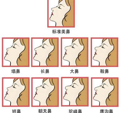 林金德鼻子案例热门分享来了!分享医生背景以及鼻子案例角度!插图1 林金德鼻子案例热门分享来了!分享医生背景以及鼻子案例角度!插图1