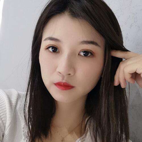 上海韩镜孙玉峰做双眼皮技术怎么样?双眼皮案例分析插图4 上海韩镜孙玉峰做双眼皮技术怎么样?双眼皮案例分析插图4