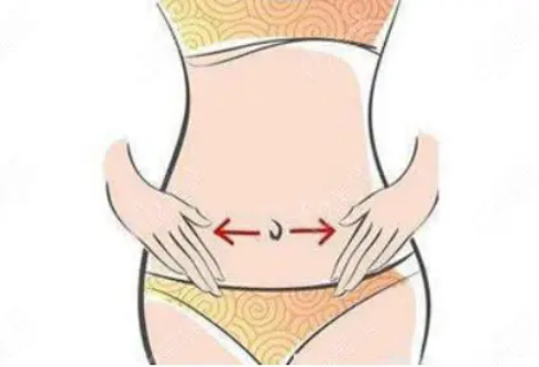 腹部吸脂的效果及安全性好不好插图