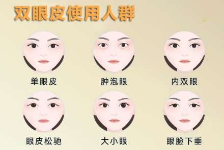 徐州双眼皮杨琳医生口碑怎么样?医生资料|坐诊医院简介|案例分析插图4 徐州双眼皮杨琳医生口碑怎么样?医生资料|坐诊医院简介|案例分析插图4