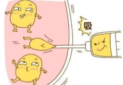 张怀军吸脂口碑怎么样？靠谱、外形自然、吸脂量准确，附医生资料&坐诊机构插图1
