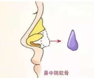 陶国贵医生是正规的吗?医院塑美造诣深厚|技术可靠!插图1 陶国贵医生是正规的吗?医院塑美造诣深厚|技术可靠!插图1