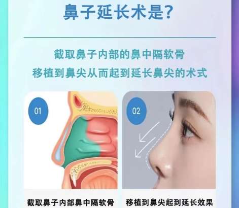 黄晓娟医生医美简介备受关注!累积了不少高品质的医学案例!插图4 黄晓娟医生医美简介备受关注!累积了不少高品质的医学案例!插图4