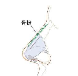 华美张国强医生各方面信息在线盘点!医生技术|术亮点一键查询!插图1 华美张国强医生各方面信息在线盘点!医生技术|术亮点一键查询!插图1