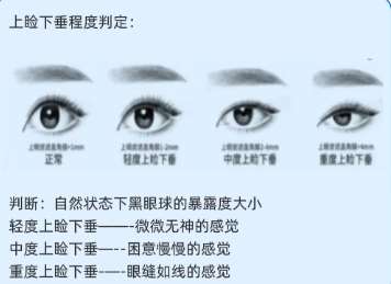叶森明医生个人简历在线查看!案例分享|整形亮点!插图4 叶森明医生个人简历在线查看!案例分享|整形亮点!插图4