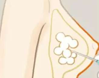 闫爱跃隆胸怎么样?就职于哪家医院?胸部整形项目流程分析插图2 闫爱跃隆胸怎么样?就职于哪家医院?胸部整形项目流程分析插图2