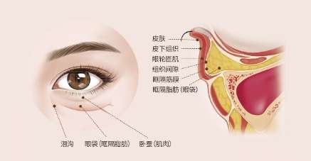 王荣锡医生做眼袋怎么样?医生履历在线分享!插图4 王荣锡医生做眼袋怎么样?医生履历在线分享!插图4