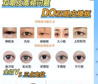 党宁医生怎么样?医生信息|眼部修复案例展示!插图4 党宁医生怎么样?医生信息|眼部修复案例展示!插图4