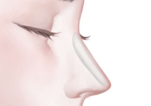 广州华美李文锋做鼻子技术怎么样?医生个人信息及坐诊医院曝光插图2 广州华美李文锋做鼻子技术怎么样?医生个人信息及坐诊医院曝光插图2