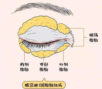 王荣锡医生做眼袋怎么样?医生履历在线分享!插图3 王荣锡医生做眼袋怎么样?医生履历在线分享!插图3