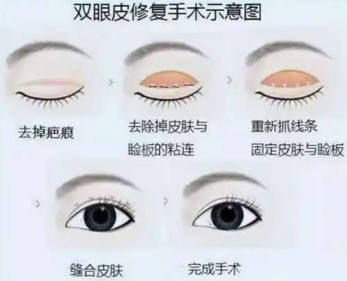胡志奇医生手术费用分析2026年在线更新!一文看清医生实力!插图1 胡志奇医生手术费用分析2026年在线更新!一文看清医生实力!插图1