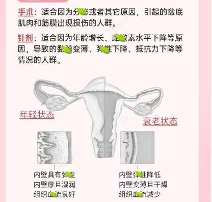 杨芒利医生擅长做什么?医生基本资料及热门项目介绍!插图4 杨芒利医生擅长做什么?医生基本资料及热门项目介绍!插图4