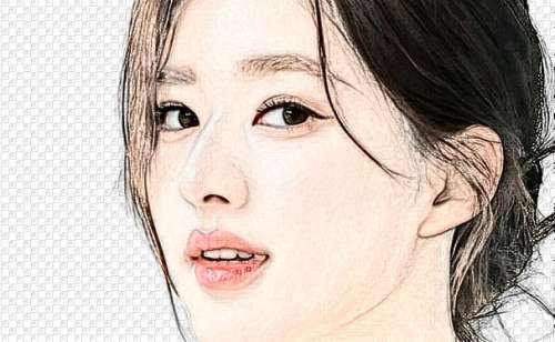 上海儿童医学中心耳朵矫正技术风格怎么样?案例分析插图1