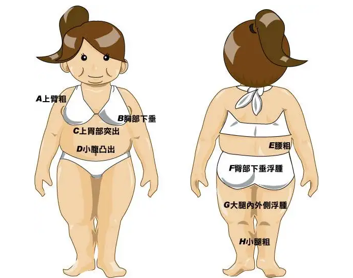 腹部抽脂术大概需要多少钱呢？插图