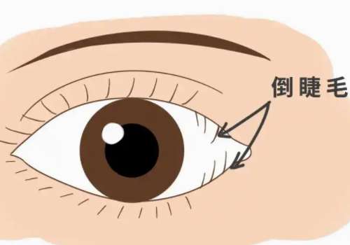 上海九院邵春益倒睫手术好吗?医生坐诊医院详情曝光插图2 上海九院邵春益倒睫手术好吗?医生坐诊医院详情曝光插图2