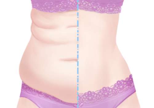 展望医生腹壁整形怎么样?内附医生个人信息、坐诊医院详情插图2 展望医生腹壁整形怎么样?内附医生个人信息、坐诊医院详情插图2
