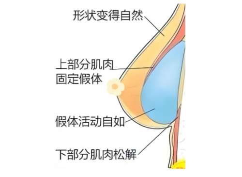 南宁隆胸医生排名推荐！医生信息公布赶紧来看吧！插图4