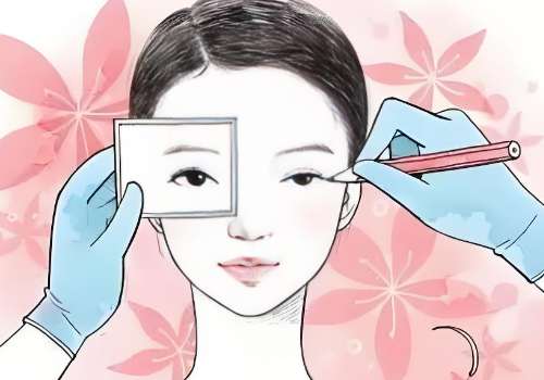 成都维星颜张春光做双眼皮口碑怎么样?自然美观，线条流畅插图1