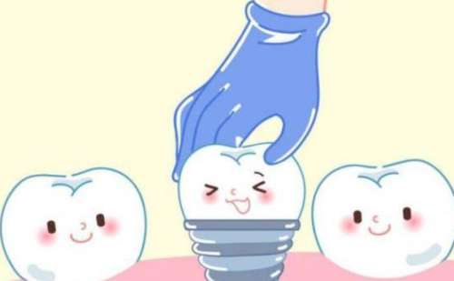 郑大一附院单颗种植牙技术评价怎么样?求美案例分析插图1 郑大一附院单颗种植牙技术评价怎么样?求美案例分析插图1