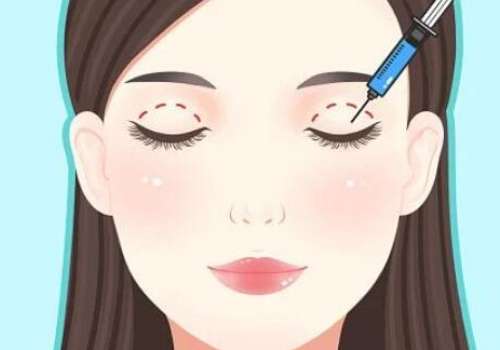 深圳双眼皮修复王志东怎么样?技术测评+坐诊医院公布插图2