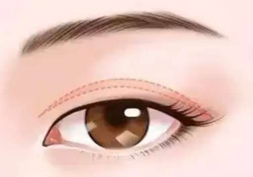 朴洪权是杭州哪家医院的?杭州薇琳顶流医生、眼鼻整形一绝插图2 朴洪权是杭州哪家医院的?杭州薇琳顶流医生、眼鼻整形一绝插图2