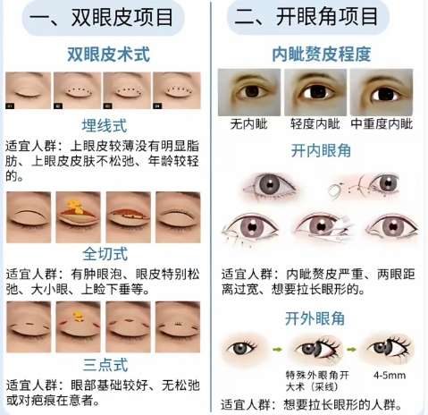 温州双眼皮修复医生排名更新啦!一文参考实力医生名单!插图4 温州双眼皮修复医生排名更新啦!一文参考实力医生名单!插图4