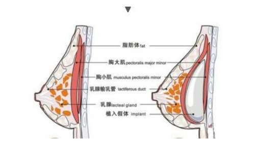 北京王驰隆胸怎么样啊?内附医生介绍及坐诊医院信息!插图2 北京王驰隆胸怎么样啊?内附医生介绍及坐诊医院信息!插图2